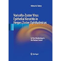 Varicella-Zoster Virus Epithelial Keratitis in Herpes Zoster Ophthalmicus: In Vivo Morphology in the Human Cornea Varicella-Zoster Virus Epithelial Keratitis in Herpes Zoster Ophthalmicus: In Vivo Morphology in the Human Cornea Kindle Paperback