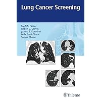 Lung Cancer Screening Lung Cancer Screening Paperback Kindle