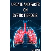 UPDATE AND FACTS ON CYSTIC FIBROSIS UPDATE AND FACTS ON CYSTIC FIBROSIS Kindle Paperback
