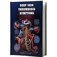 Deep Vein Thrombosis Symptoms: Learn about the symptoms of deep vein thrombosis (DVT), a blood clot in a deep vein, and the associated risks. Deep Vein Thrombosis Symptoms: Learn about the symptoms of deep vein thrombosis (DVT), a blood clot in a deep vein, and the associated risks. Paperback