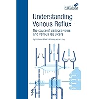 Understanding Venous Reflux the Cause of Varicose Veins and Venous Leg Ulcers: Varicose veins and venous leg ulcers (College of Phlebology) Understanding Venous Reflux the Cause of Varicose Veins and Venous Leg Ulcers: Varicose veins and venous leg ulcers (College of Phlebology) Paperback Kindle