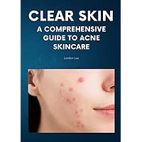 Clear Skin: A Comprehensive Guide to Acne Skincare: An Acne Book on How to Get Rid of Acne