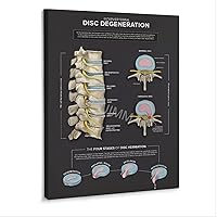 WENHUIMM Levels of Spinal Degeneration Chiropractors Spine Knowledge Guide Poster (3) Home Living Room Bedroom Decoration Gift Printing Art Poster Frame-style 12x16inch(30x40cm)