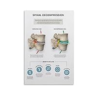 LCWAMSNB Popular Science Poster on Treatment And Prevention of Lumbar Disc Herniation (2) Wall Poster Art Canvas Printing Gift Office Bedroom Aesthetic Poster 08x12inch(20x30cm) Unframe-style
