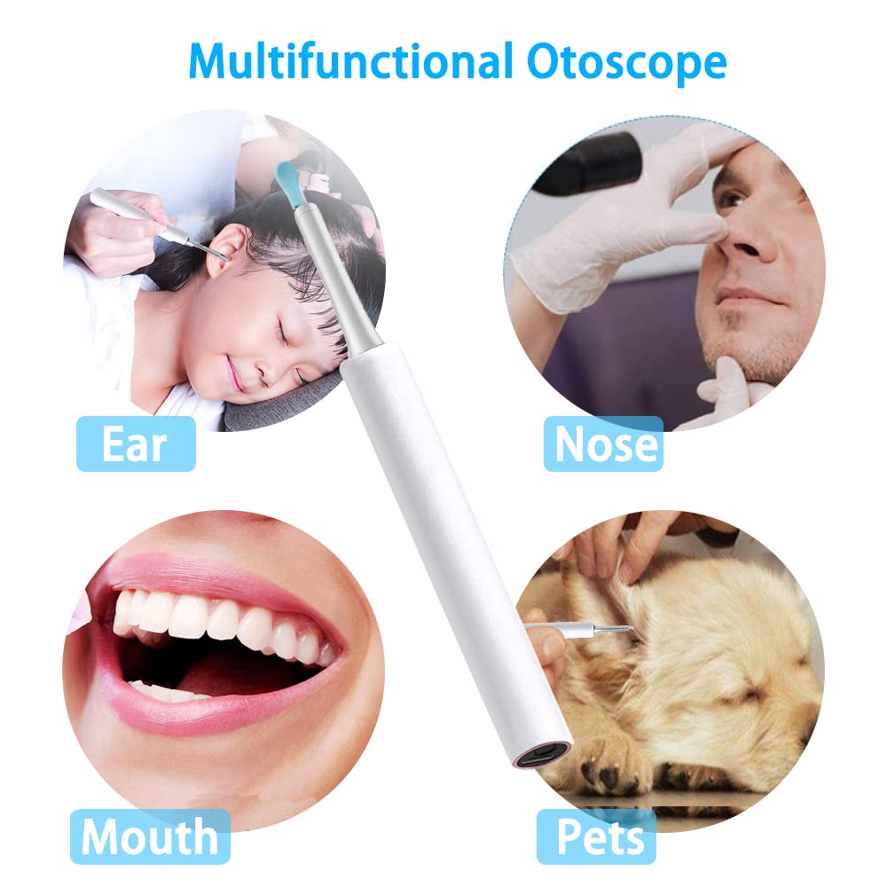 Ear Wax Removal Endoscope Otoscope, Earwax Remover Tools, Scope, with 1080P FHD Camera, 6 Led Lights, Wireless Connected, Compatible with iPhone, iPad, Android Smart Phones & Tablets (White)