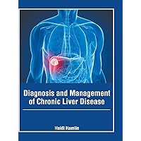 Diagnosis and Management of Chronic Liver Disease