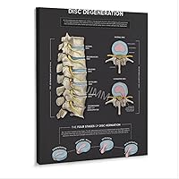 WENHUIMM Levels of Spinal Degeneration Chiropractors Spine Knowledge Guide Poster (3) Home Living Room Bedroom Decoration Gift Printing Art Poster Frame-style 20x24inch(50x60cm)