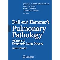 Dail and Hammar's Pulmonary Pathology: Volume II: Neoplastic Lung Disease Dail and Hammar's Pulmonary Pathology: Volume II: Neoplastic Lung Disease Hardcover Paperback
