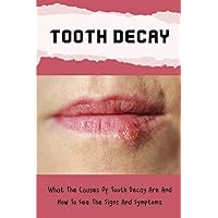 Tooth Decay: What The Causes Of Tooth Decay Are And How To See The Signs And Symptoms