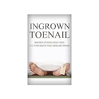 Foot Pain: Ingrown Toenail: How To Become Stress Free And Easily Cure This Nasty Nail Disease Today From The Comfort Of Your Own Home (Foot Pain, Foot Problems, Foot Pain Relief, Foot Reflexology)