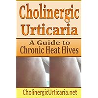 Cholinergic Urticaria: A Guide to Chronic Heat Hives Cholinergic Urticaria: A Guide to Chronic Heat Hives Paperback Kindle
