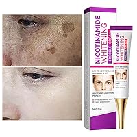 Face Cream Dark Spot Remover for Face, Skin Lightening Cream, Hyperpigmentation Treatment Quick Effect, Freckles Melasma Brown Spot Corrector for Men Women (0.8 FL.OZ)