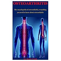 Osteoarthritis: The Encyclopedia Of Osteoarthritis; Everything You Need To Know About Osteoarthritis Osteoarthritis: The Encyclopedia Of Osteoarthritis; Everything You Need To Know About Osteoarthritis Paperback