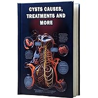 Cysts Causes, Treatments and More: Explore the diverse causes of cysts and learn about available treatment options for managing these fluid-filled sacs. Cysts Causes, Treatments and More: Explore the diverse causes of cysts and learn about available treatment options for managing these fluid-filled sacs. Paperback