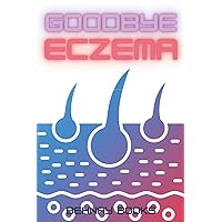Goodbye Eczema: A Method Of Eczema Treatment That Is Both All-Natural and Risk-Free Goodbye Eczema: A Method Of Eczema Treatment That Is Both All-Natural and Risk-Free Paperback Kindle