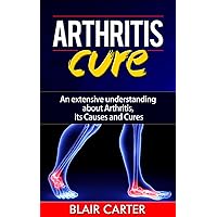 Arthritis Cure－An extensive understanding about Arthritis, its Causes and Cures