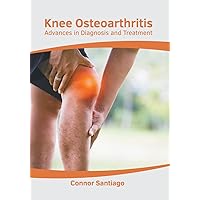 Knee Osteoarthritis: Advances in Diagnosis and Treatment Knee Osteoarthritis: Advances in Diagnosis and Treatment Hardcover