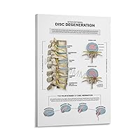 WENHUIMM Levels of Spinal Degeneration Chiropractors Spine Knowledge Guide Poster (2) Home Living Room Bedroom Decoration Gift Printing Art Poster Frame-style 12x18inch(30x45cm)