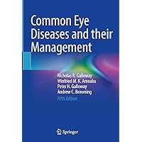 Common Eye Diseases and their Management Common Eye Diseases and their Management Kindle Hardcover Paperback