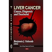 Liver Cancer: Causes, Diagnosis and Treatment (Cancer Etiology, Diagnosis and Treatments) Liver Cancer: Causes, Diagnosis and Treatment (Cancer Etiology, Diagnosis and Treatments) Hardcover
