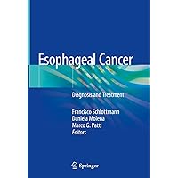 Esophageal Cancer: Diagnosis and Treatment Esophageal Cancer: Diagnosis and Treatment Kindle Hardcover Paperback
