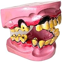 Study Model Diseased Teeth Model - Common Odontology Model of Human Smokers Pathological Tooth Oral Model - Oral Care Patient Education Dental Model
