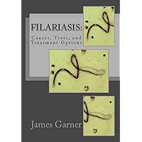 Filariasis: Causes, Tests, and Treatment Options Filariasis: Causes, Tests, and Treatment Options Kindle Paperback