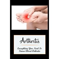 Arthritis: Everything You Need To Know About Arthritis