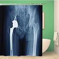 Bathroom Shower Curtain X Ray Scan of Hip Joints Orthopedic Replacement Total 60x72 inches Waterproof Bath Curtain Set with Hooks