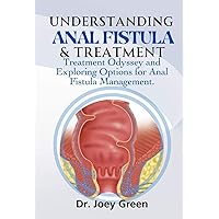 Understanding Anal Fistula & Treatment: Treatment Odyssey and Exploring Options for Anal Fistula Management. Understanding Anal Fistula & Treatment: Treatment Odyssey and Exploring Options for Anal Fistula Management. Kindle Paperback