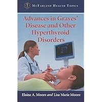 Advances in Graves' Disease and Other Hyperthyroid Disorders (McFarland Health Topics) Advances in Graves' Disease and Other Hyperthyroid Disorders (McFarland Health Topics) Paperback Kindle
