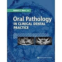 Oral Pathology in Clinical Dental Practice Oral Pathology in Clinical Dental Practice Hardcover Kindle