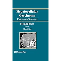 Hepatocellular Carcinoma: Diagnosis and Treatment (Current Clinical Oncology) Hepatocellular Carcinoma: Diagnosis and Treatment (Current Clinical Oncology) Kindle Hardcover
