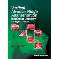Vertical Alveolar Ridge Augmentation in Implant Dentistry: A Surgical Manual Vertical Alveolar Ridge Augmentation in Implant Dentistry: A Surgical Manual Hardcover