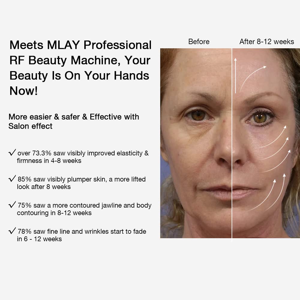 Mua RF Beauty Machine | Lifting | Toning | Wrinkle Removal | MLAY RF Radio  Frequency Facial and Body Skin Tightening Machine - Professional Home RF  Anti Aging Device - Salon Effects（Gel