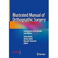 Illustrated Manual of Orthognathic Surgery: Osteotomies of the Maxilla and Midface Illustrated Manual of Orthognathic Surgery: Osteotomies of the Maxilla and Midface Hardcover Kindle
