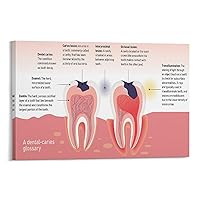 GEBSKI Dental Caries Stage of Development Poster Dental Care Infographic Poster Dental Clinic Poster Canvas Painting Wall Art Poster for Bedroom Living Room Decor 08x12inch(20x30cm) Frame-style