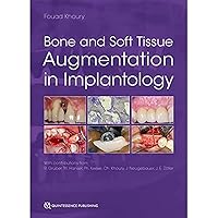 Bone and Soft Tissue Augmentation in Implantology Bone and Soft Tissue Augmentation in Implantology Hardcover Kindle