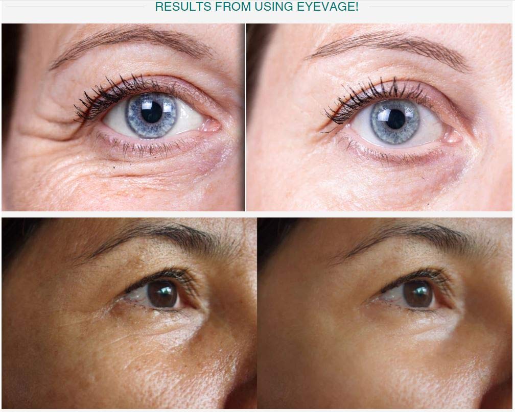Solvaderm Eyevage Anti-Aging Eye Rejuvenation Treatment Cream For Puffy Eyes, Dark Circles, Fine Lines, Wrinkles & Crow’s Feet