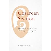 Cesarean Section: An American History of Risk, Technology, and Consequence Cesarean Section: An American History of Risk, Technology, and Consequence Paperback Kindle Hardcover