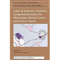 Atlas of Selective Sentinel Lymphadenectomy for Melanoma, Breast Cancer and Colon Cancer (Cancer Treatment and Research Book 111) Atlas of Selective Sentinel Lymphadenectomy for Melanoma, Breast Cancer and Colon Cancer (Cancer Treatment and Research Book 111) Kindle Hardcover Paperback