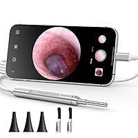 Anykit Ear Wax Removal Tool, Ultra Clear View Ear Scope with LED Lights for Ear Cleaning, Ear Cleaner Camera Otoscope with Ear Spoon & Specula for iPhone & Android