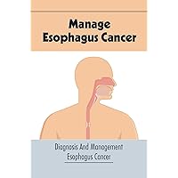 Manage Esophagus Cancer: Diagnosis And Management Esophagus Cancer
