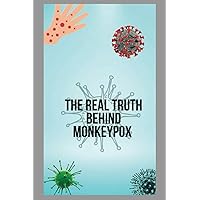 The Real Truth Behind Monkeypox: All You Need to know About Monkeypox: Treatment, Diagnosis, Vaccines and How serious Monkeypox Is