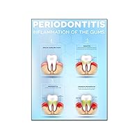 MOJDI Periodontitis Gingival Symptoms Poster Dental Health Poster Canvas Painting Posters And Prints Wall Art Pictures for Living Room Bedroom Decor 12x16inch(30x40cm) Frame-style