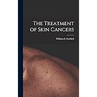 The Treatment of Skin Cancers The Treatment of Skin Cancers Hardcover Paperback