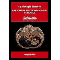 ANATOMY OF THE THORACIC SPINE CT IMAGES: Spine images collection ANATOMY OF THE THORACIC SPINE CT IMAGES: Spine images collection Kindle Paperback