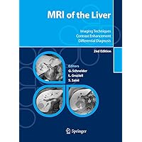 MRI of the Liver: Imaging Techniques, Contrast Enhancement, Differential Diagnosis MRI of the Liver: Imaging Techniques, Contrast Enhancement, Differential Diagnosis Hardcover Kindle Paperback