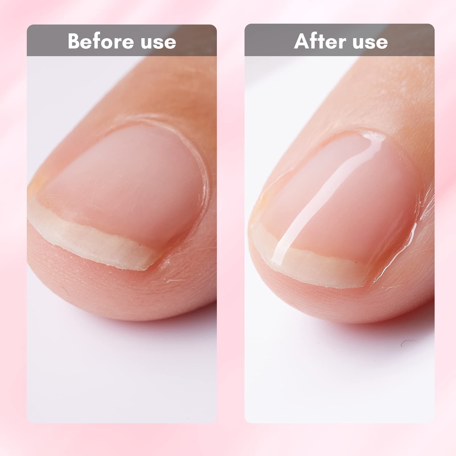 Orly Breathable Calcium Boost Nail Strengthener - Compare Prices & Where To  Buy - Trolley.co.uk