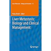 Liver Metastasis: Biology and Clinical Management (Cancer Metastasis - Biology and Treatment Book 16) Liver Metastasis: Biology and Clinical Management (Cancer Metastasis - Biology and Treatment Book 16) Kindle Hardcover Paperback
